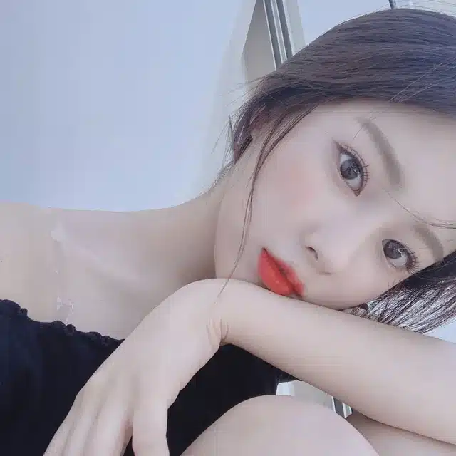 cắt mí mắt