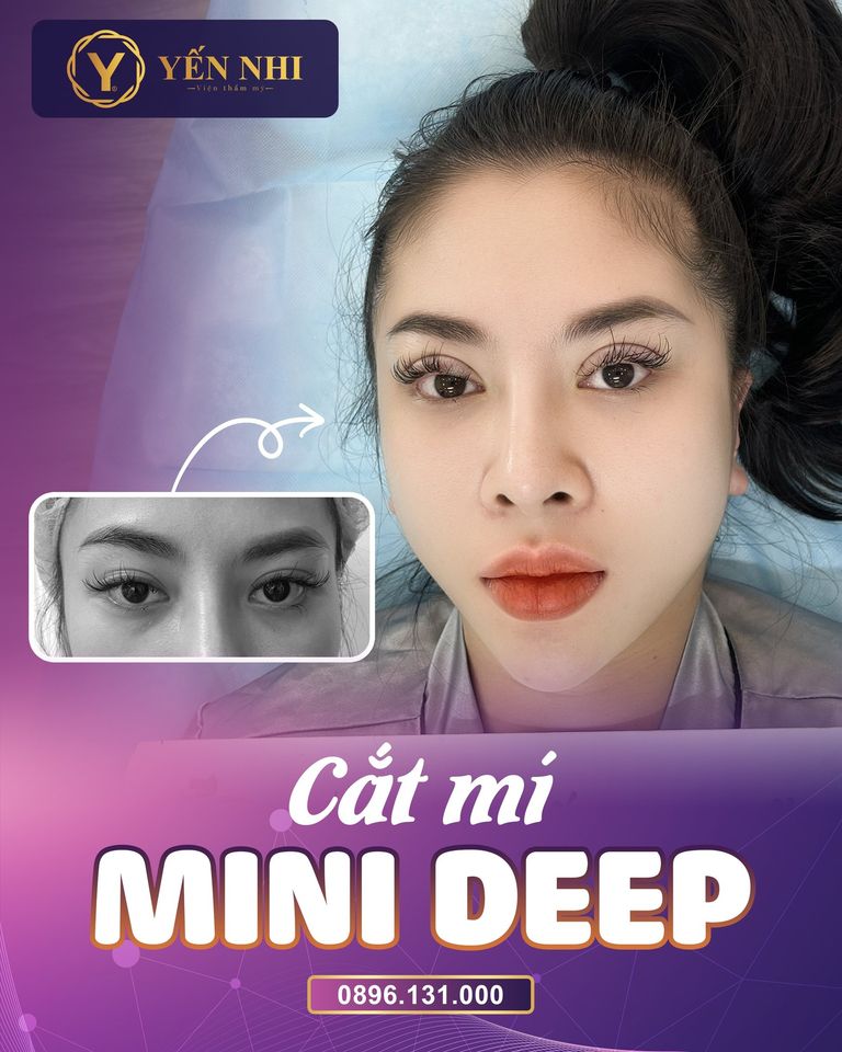 mini deep