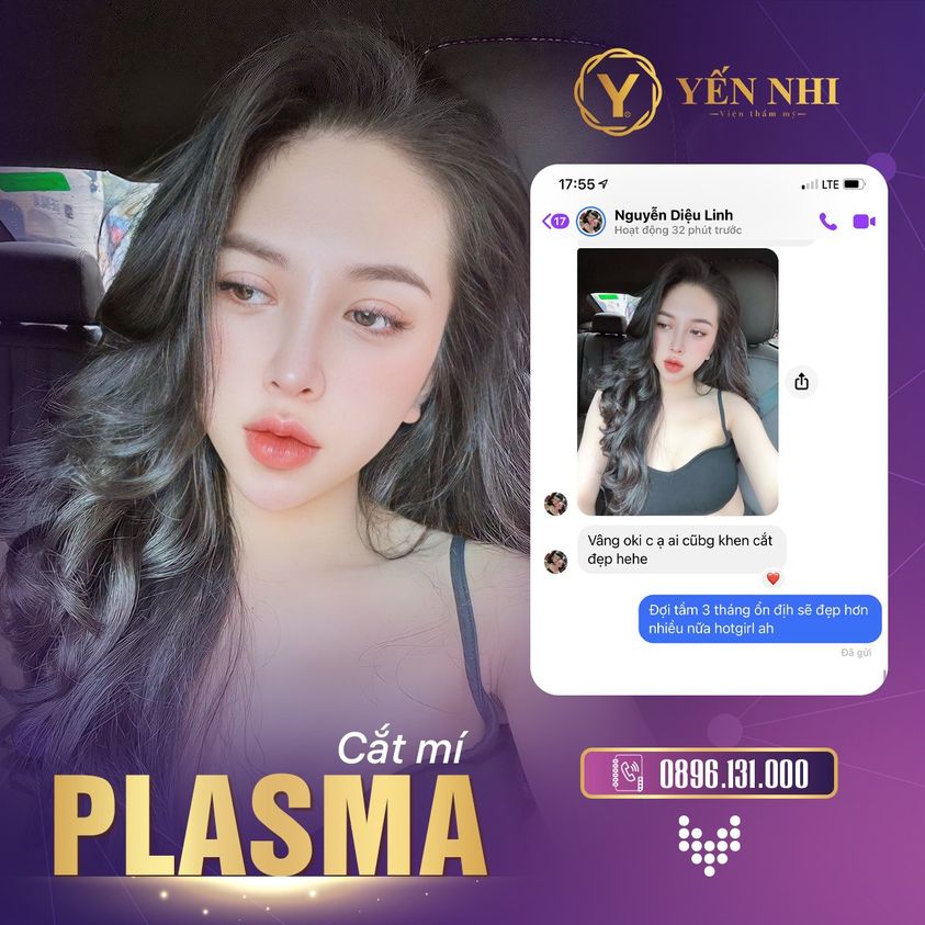 cắt mí plasma