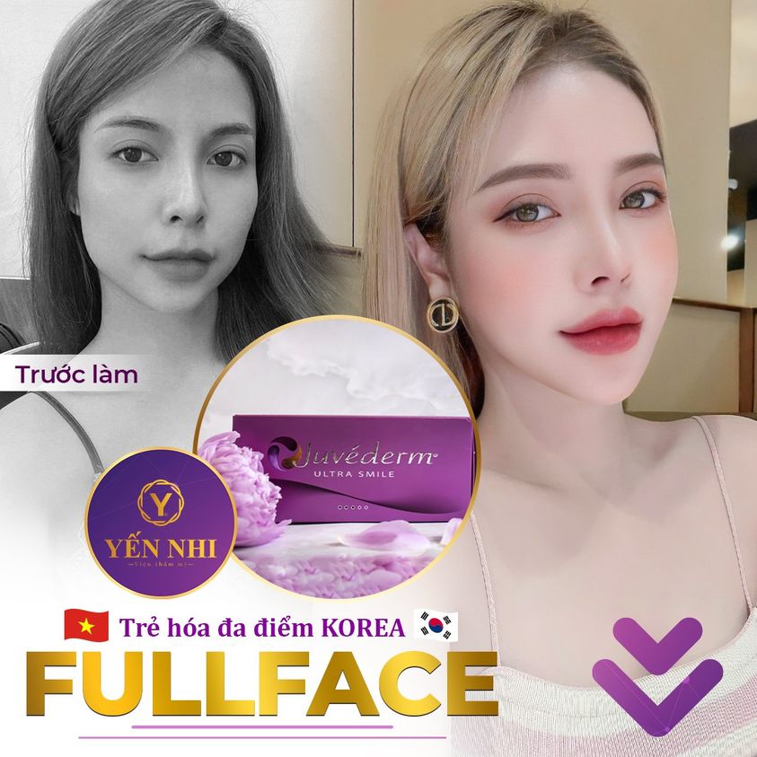 trẻ hóa Yến Nhi