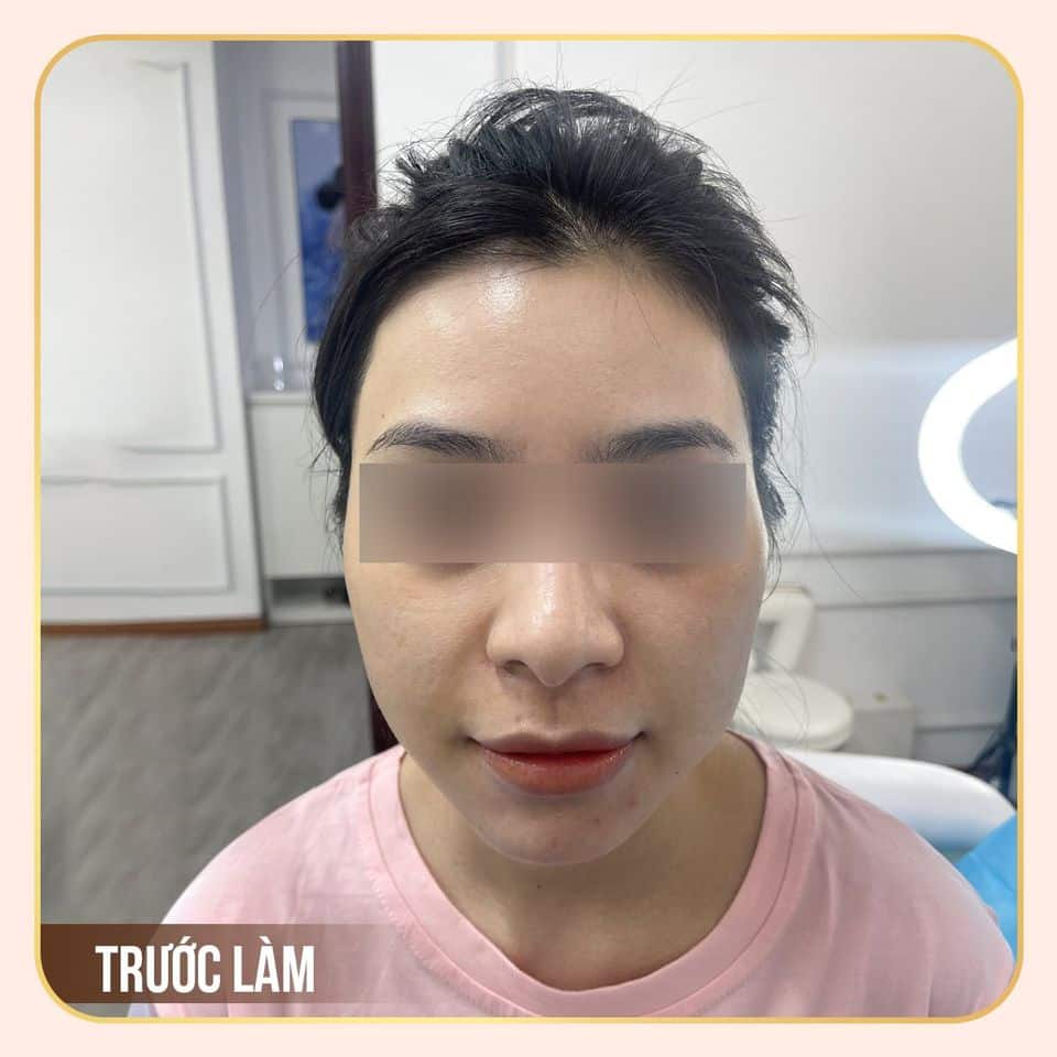 feedback thẩm mỹ