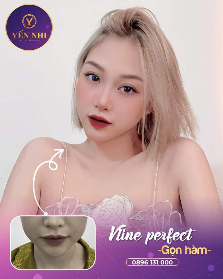 Vline Perfect